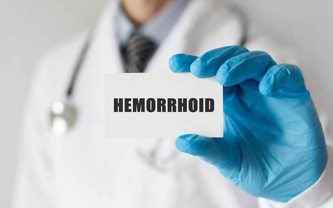 Hemorrhoids: Going Through the Motions