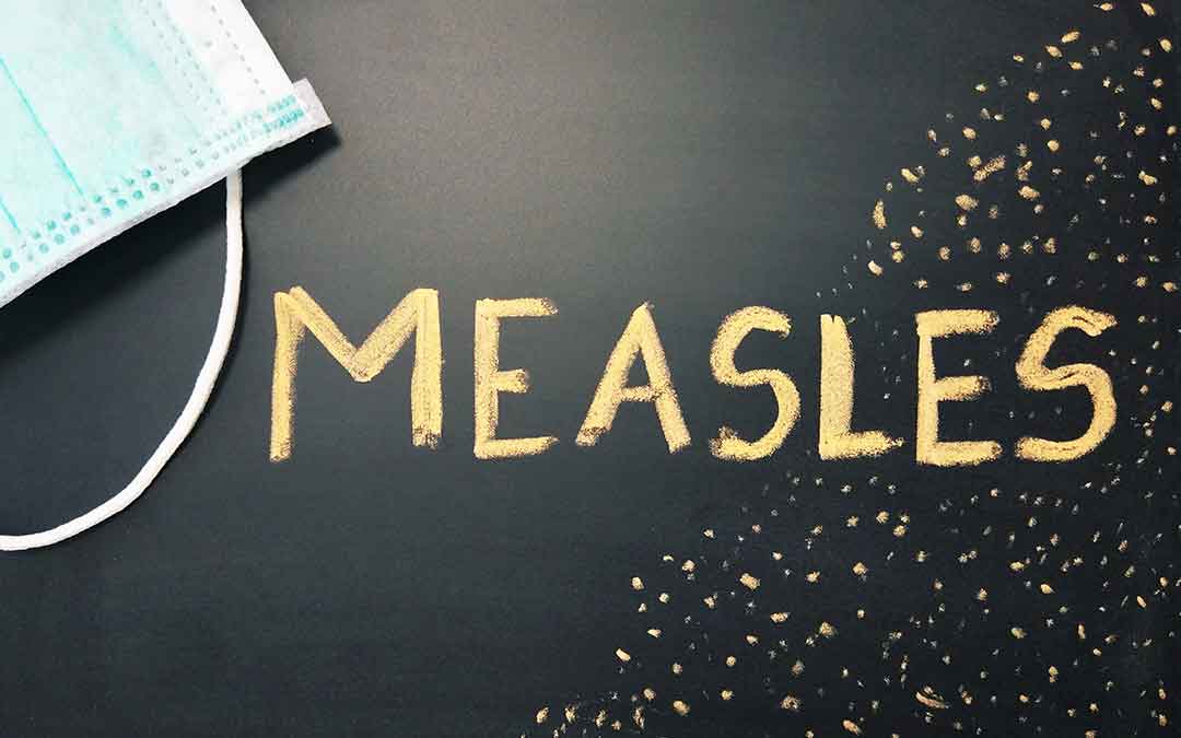 Watch Out for these Measles Symptoms in Your Child