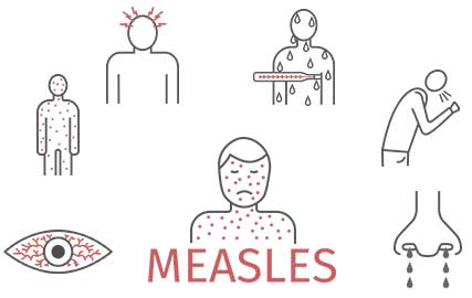 All You Need To Know About Measles | mfine