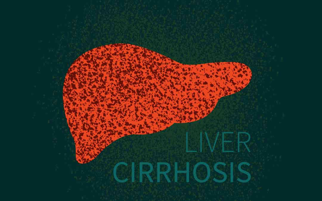 Like Alcohol? You Are Prone To Liver Cirrhosis
