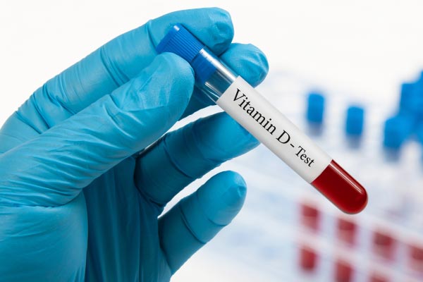 health check-ups vitamin D test mfine