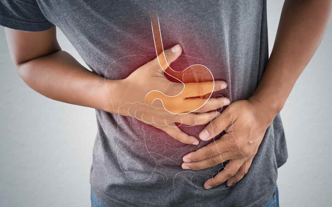 What Causes Stomach Ulcers & How To Relieve Them