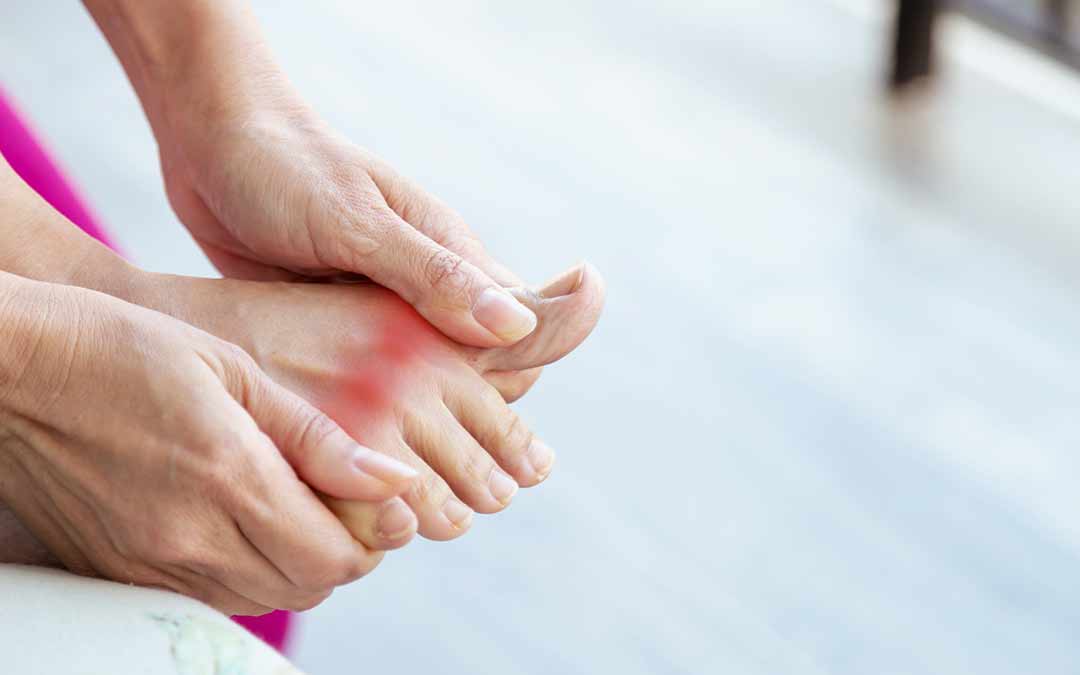 Gout Facts That You Should Be Aware Of