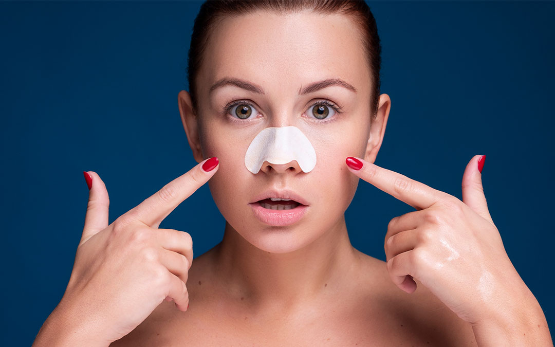 What Are Blackheads and How To Prevent Them?