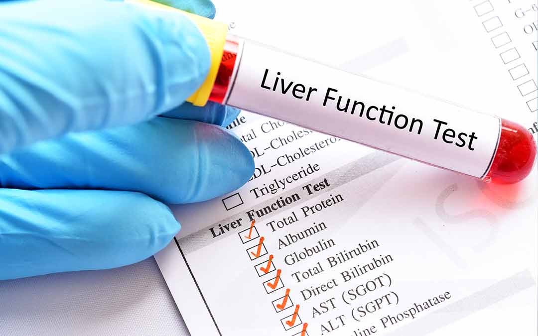 What Does A Hepatic Function Panel Test For