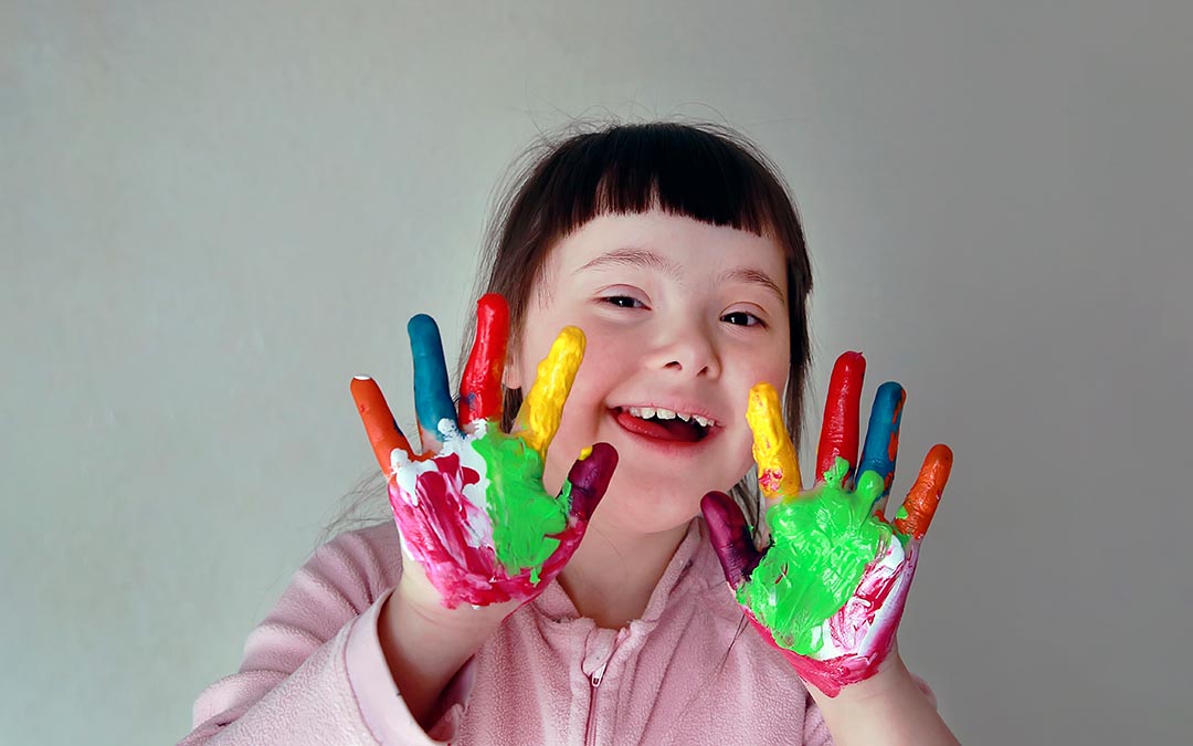 7 Facts Everyone Should Know About Down’s Syndrome