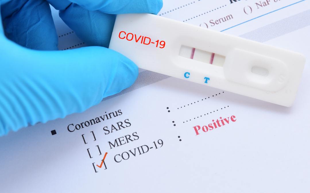 10 Things To Do When You Test Positive For COVID-19