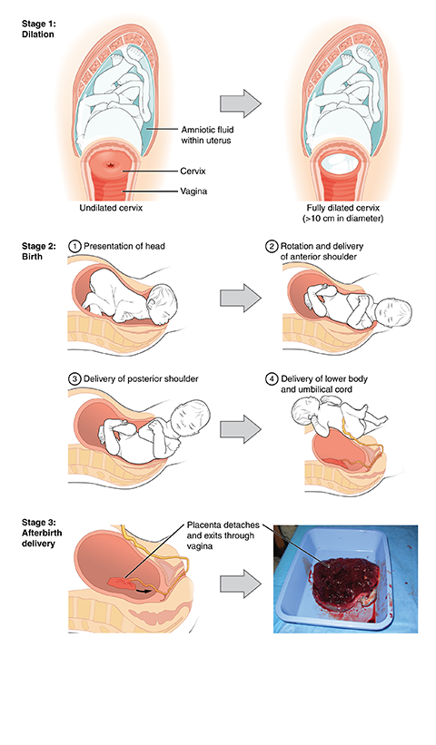 Pregnancy Normal Delivery Pictures 