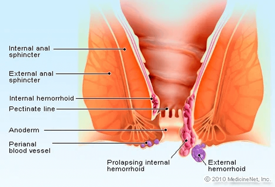 difference between piles and fistula