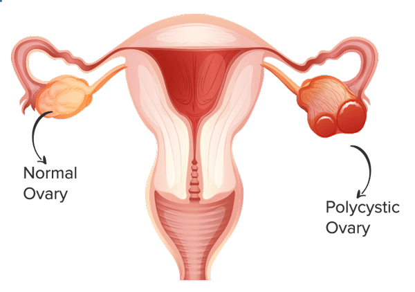 ovary