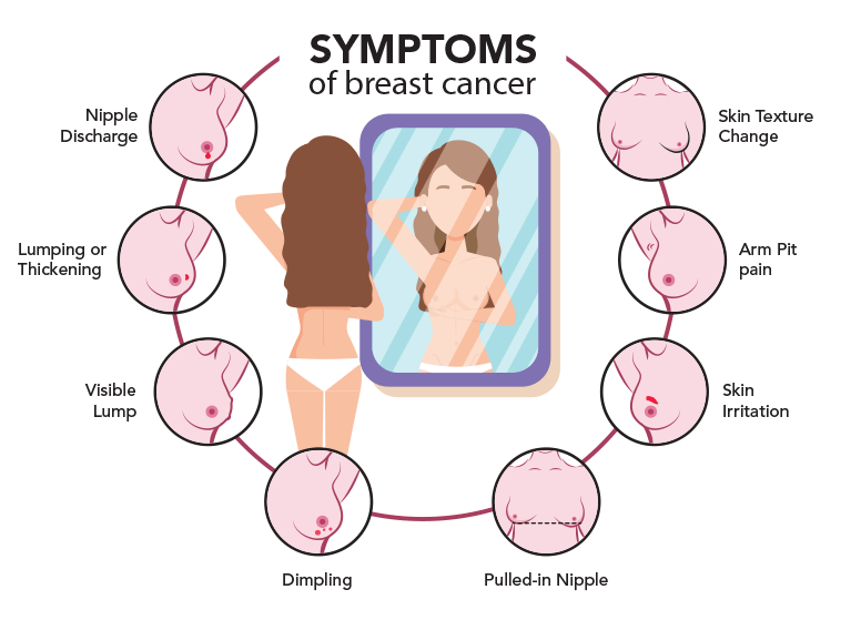 symptoms of breast cancer 