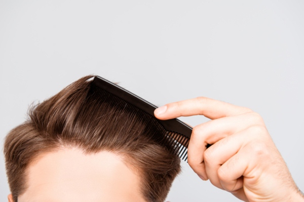 manage hair loss combing hair brushing hair mfine