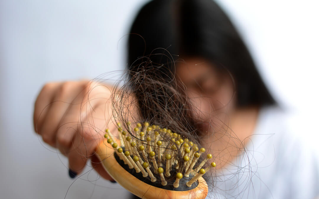 PCOS Hair fall: Management Of PCOS Hair Loss In Women | MFine