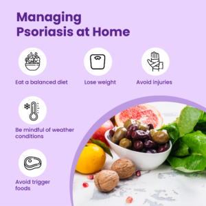 managing psoriasis at home