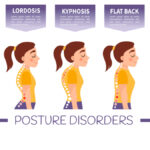 types of posture