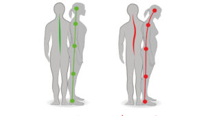 types of posture-standing correctly
