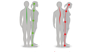 Types of Posture: How to Correct Bad Posture