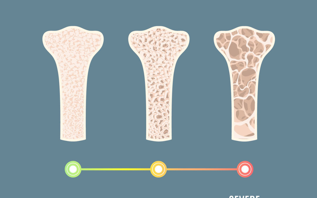 What are the types of osteoporosis?