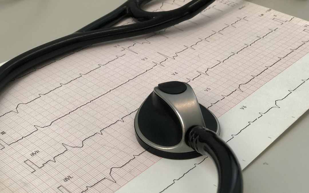 Why is an ECG done before surgery?