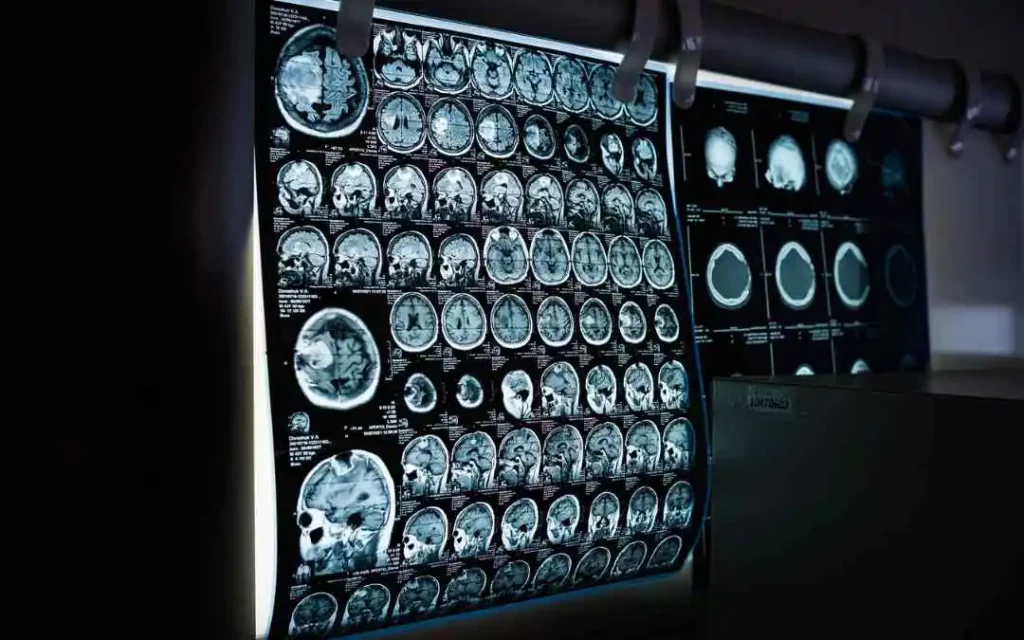 how many types of x ray