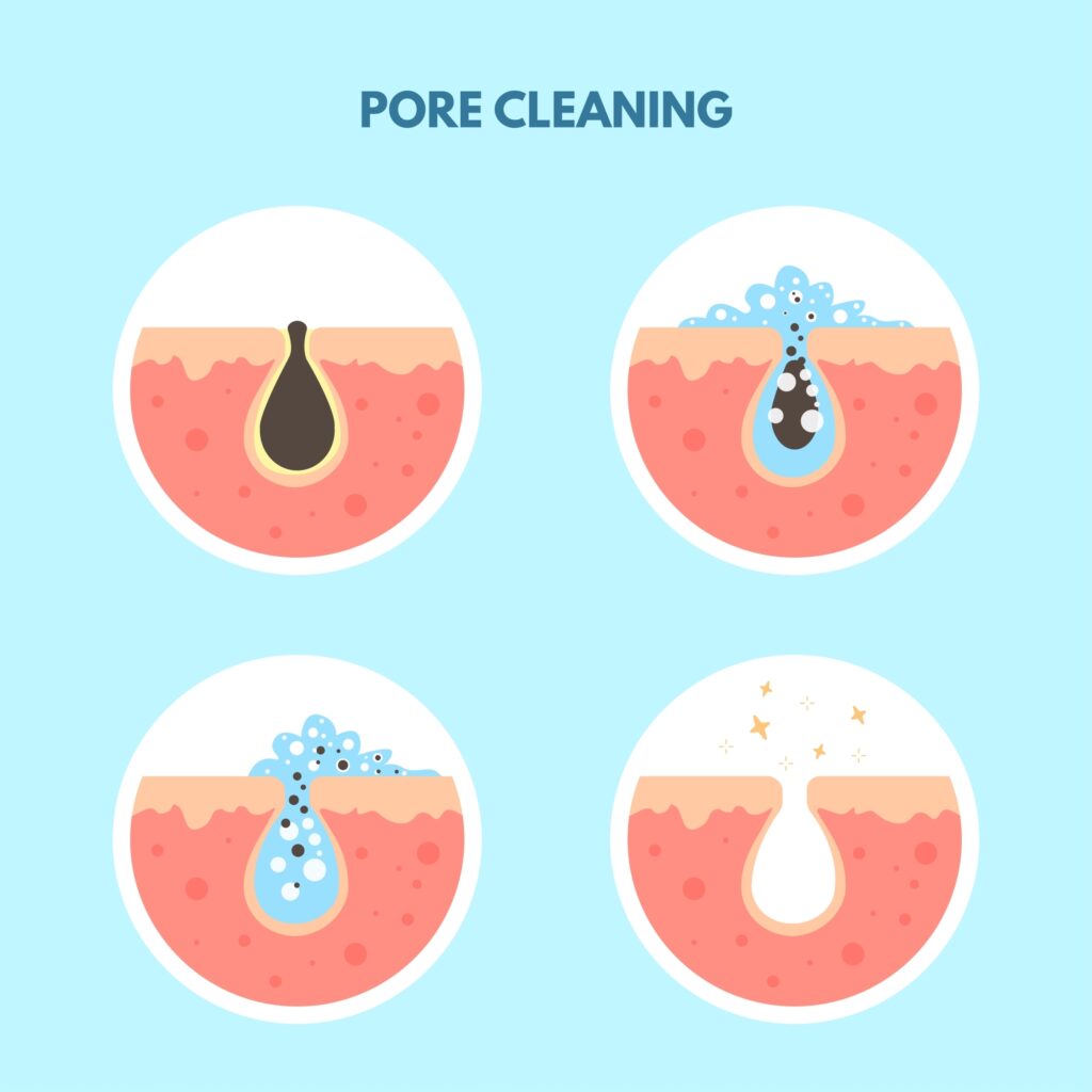open pores treatment-pore cleaning