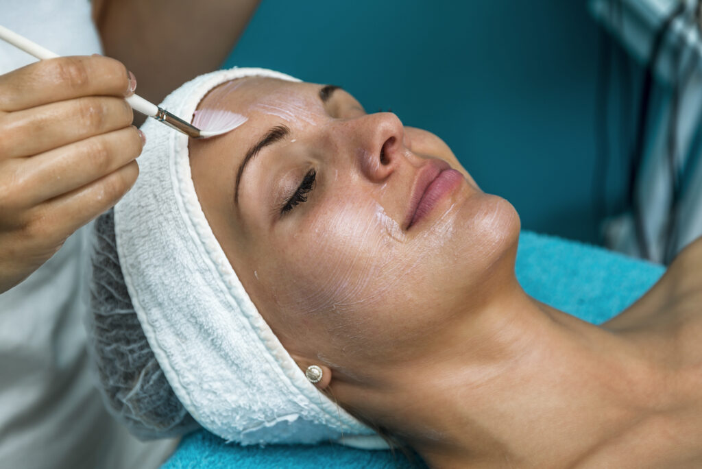 open pores treatment-chemical peels