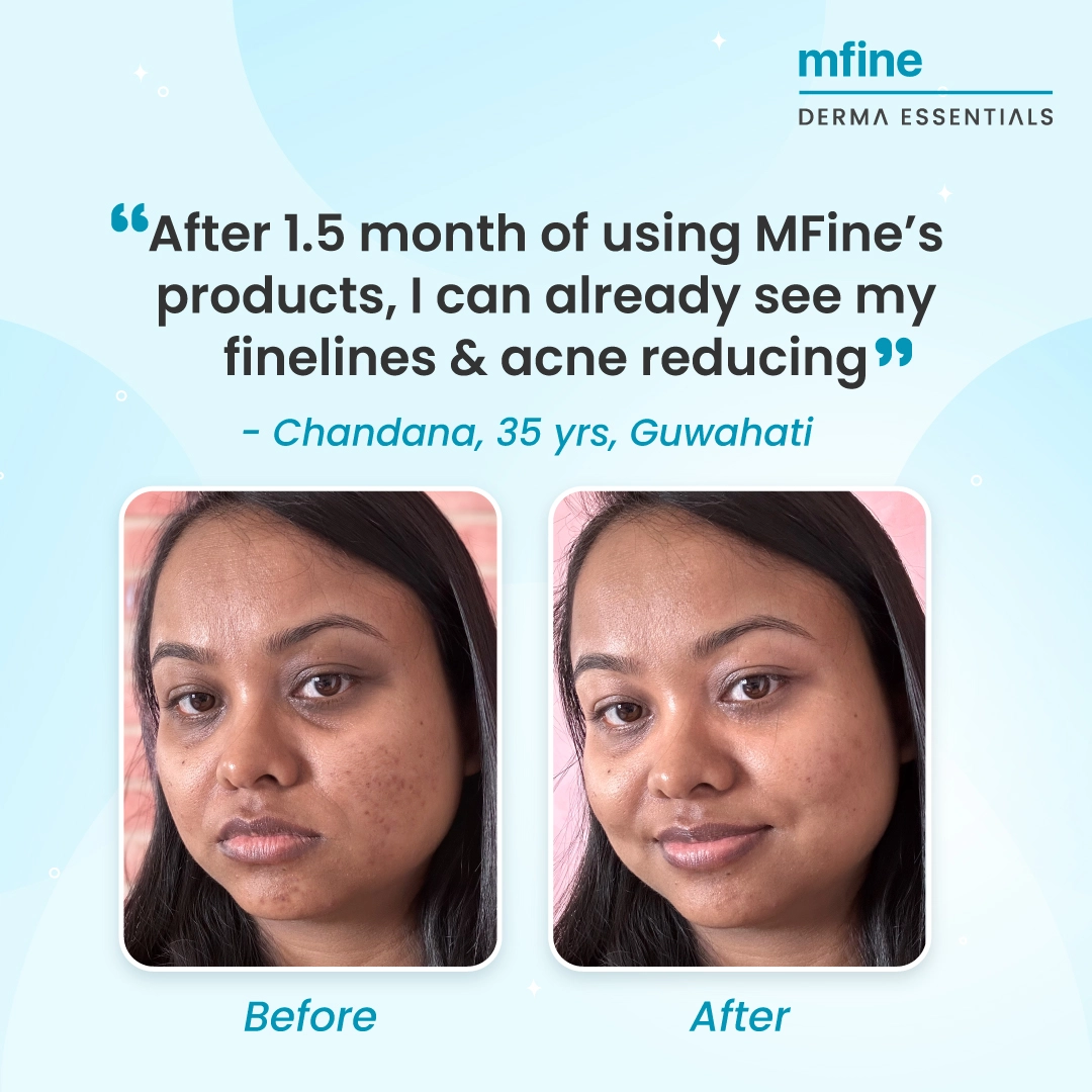 before and after pictures after using anti ageing products